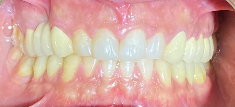 Muş Özel Diş Kliniği After