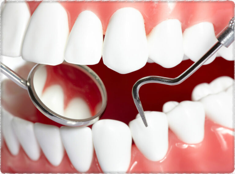 Muş Diş Beyazlatma