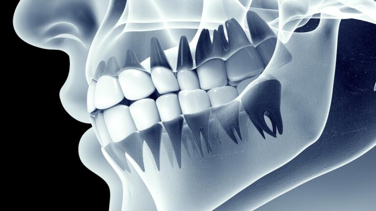 Muş merkez diş filmi çektirme