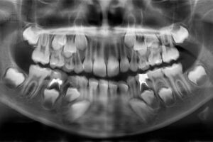 Özel Diş Hekimi Muş